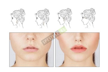 60бр. Лифтинг пластири за лице-foto4