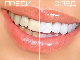 Писалка за избелване на зъби - Teeth Whitening Pen-foto2