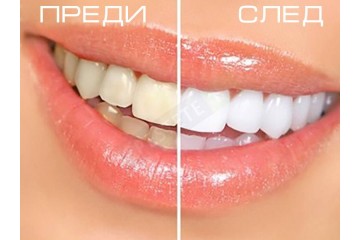 Писалка за избелване на зъби - Teeth Whitening Pen-foto2