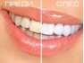 Писалка за избелване на зъби - Teeth Whitening Pen