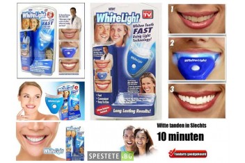 Система за избелване на зъби - Whitelight-foto3