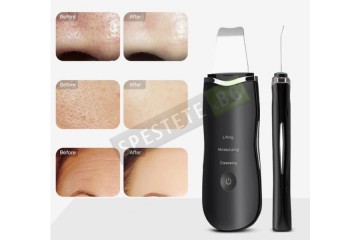 Уред за почистване на лице-foto3