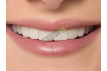 Декоративни изкуствени зъби-foto4