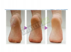 Четка за почистване на крака за баня-foto5