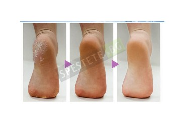 Четка за почистване на крака за баня-foto5