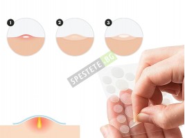 Лепенки против акне-foto3