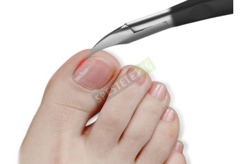 Медицински клещи за дебели и враснали нокти-foto2