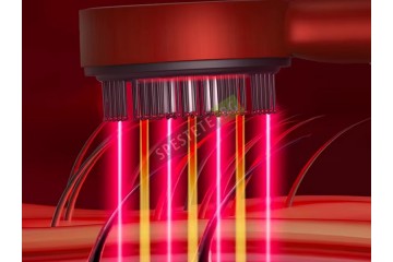 Електрическа четка за масаж на скалпа-foto3