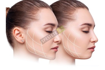 Уред за тренировка на мускулите на лицето-foto2