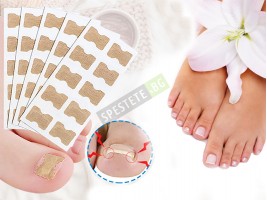 Лепенки за врасъл нокът 50бр.-foto2