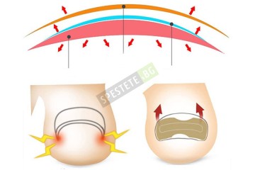 Лепенки за врасъл нокът 50бр.-foto4